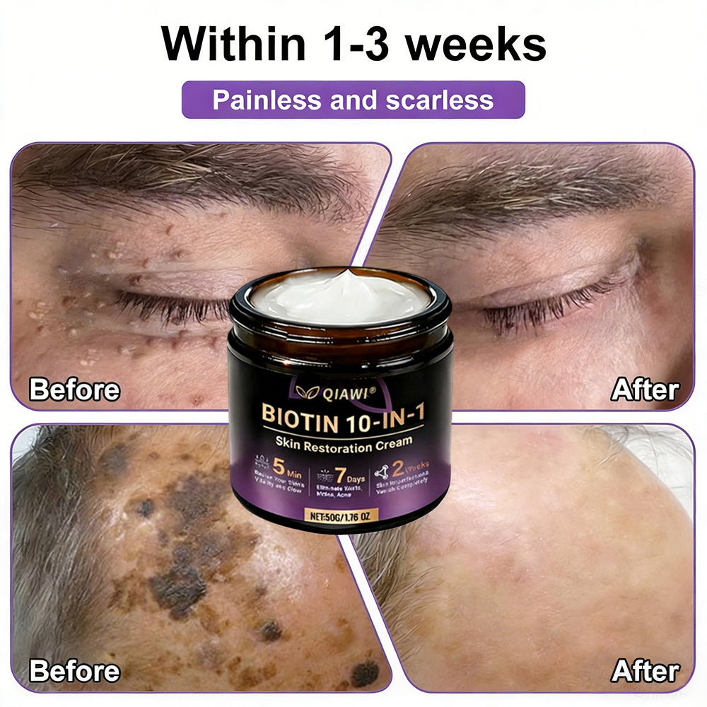🔥LAST DAY 50% OFF - QIAWI® Biotin 10-in-1 Skin Restoration Cream-XDX