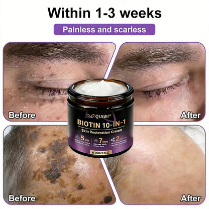 🔥LAST DAY 50% OFF - QIAWI® Biotin 10-in-1 Skin Restoration Cream-XDX