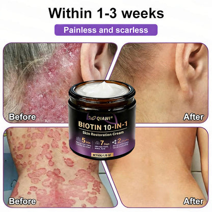 🔥LAST DAY 50% OFF - QIAWI® Biotin 10-in-1 Skin Restoration Cream-XDX