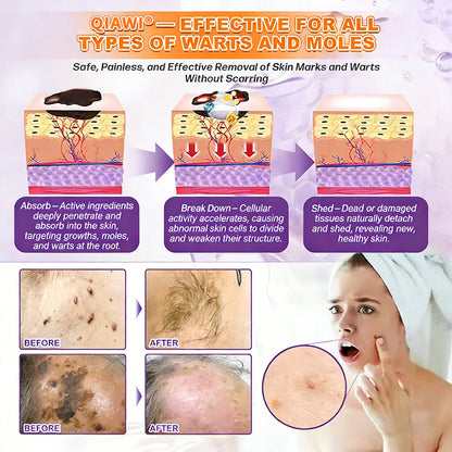 🔥LAST DAY 50% OFF - QIAWI® Biotin 10-in-1 Skin Restoration Cream-XDX