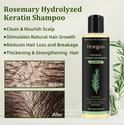 Urgent!🌿 Rosemary Oil Shampoo Works – Hair Growth Starts Now!-XDX