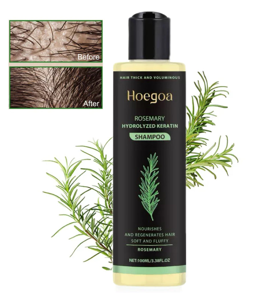 Urgent!🌿 Rosemary Oil Shampoo Works – Hair Growth Starts Now!-XDX