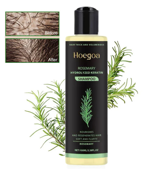 🌱 Organic Rosemary Hair Growth Shampoo-XDX-FB