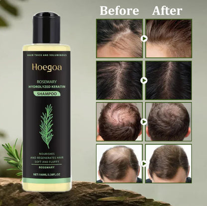 Urgent!🌿 Rosemary Oil Shampoo Works – Hair Growth Starts Now!-XDX