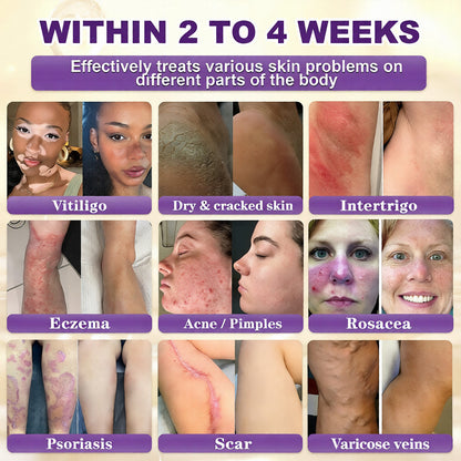 🔥LAST DAY 50% OFF - QIAWI® Biotin 10-in-1 Skin Restoration Cream-XDX