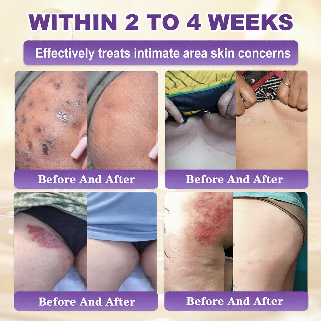 🔥LAST DAY 50% OFF - QIAWI® Biotin 10-in-1 Skin Restoration Cream-XDX