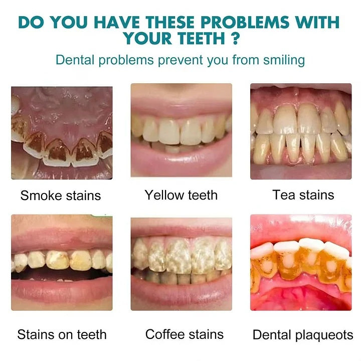 Final3 Hours: 33 %OFF Tooth Polish -Instantly Whiter Teeth-XDX