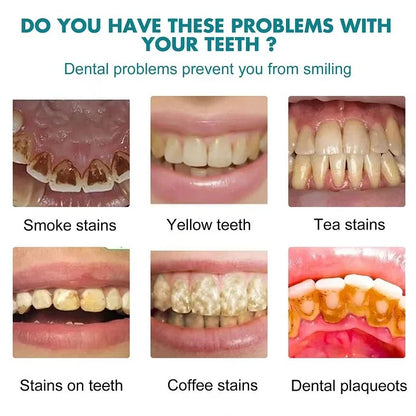 Final3 Hours: 33 %OFF Tooth Polish -Instantly Whiter Teeth-XDX