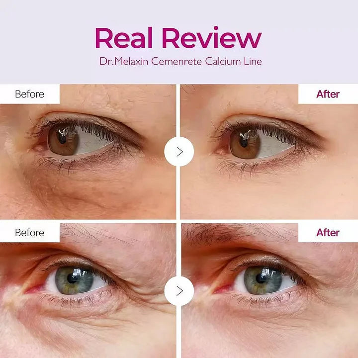 ✨Limited-Time Offer✨Calcium Volume Multi Balm+Eye Patch 60ea Korean Skin Care Cosmetics with Collagen Extract Elasticity Eye Shield Skin Repair-HHW
