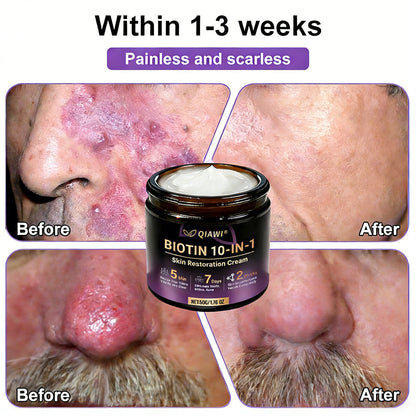 🔥LAST DAY 50% OFF - QIAWI® Biotin 10-in-1 Skin Restoration Cream-XDX