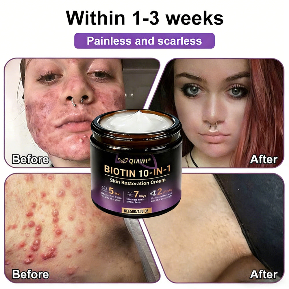 🔥LAST DAY 50% OFF - QIAWI® Biotin 10-in-1 Skin Restoration Cream-XDX