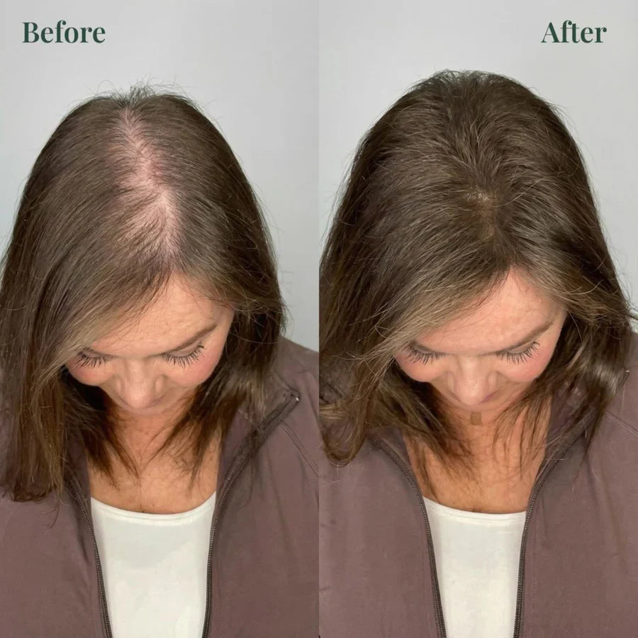 Urgent!🌿 Rosemary Oil Shampoo Works – Hair Growth Starts Now!-XDX
