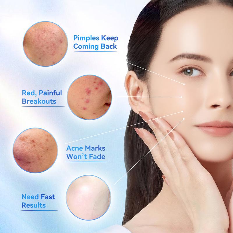 Dr.Leo 24H Acne Treatment Drying Lotion | Salicylic Acid + Sulfur + Niacinamide | Viral Product | Inflammation Relief, Post-Blemish Care & Oil Control | Free Shipping —XDX