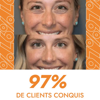 Crème Anti Cernes et Rides Instantanée-XDX