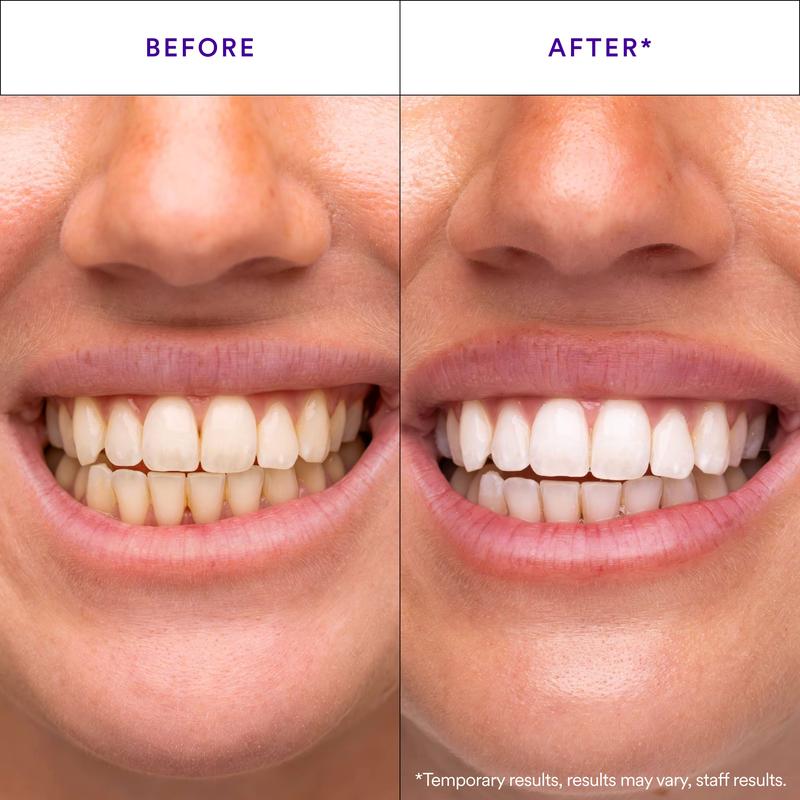 Buy One Get One Free-V34 Whitening Strips, Teeth Whitening Strips, Purple Tooth Whitening, Tooth Stain Treatment, Combining Whitening and Colour Correction-HHW