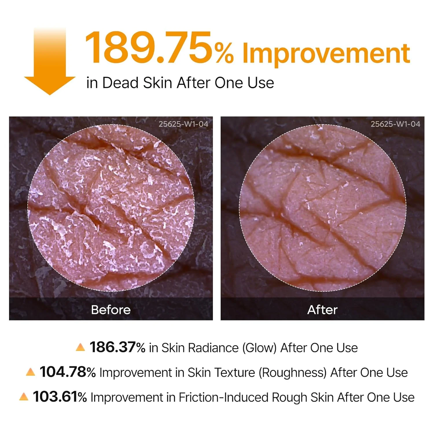 Peel Shot Keratin Care Kojic Acid Turmeric Spray 200ml Pore Clearing Exfoliating Formula-XDX