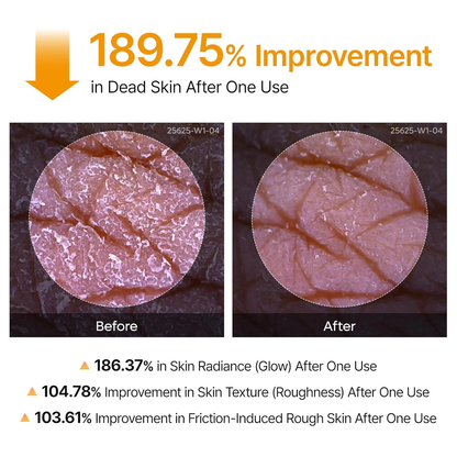 Peel Shot Keratin Care Kojic Acid Turmeric Spray 200ml Pore Clearing Exfoliating Formula-XDX